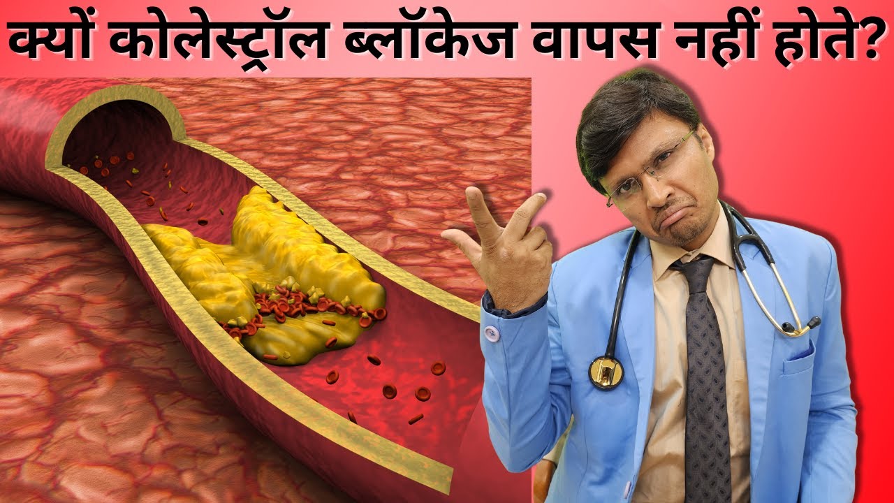WHY IS REVERSAL OF CHOLESTEROL BLOCKAGES NOT POSSIBLE / क्यों कोलेस्ट्रॉल ब्लॉकेज वापस नहीं होते?