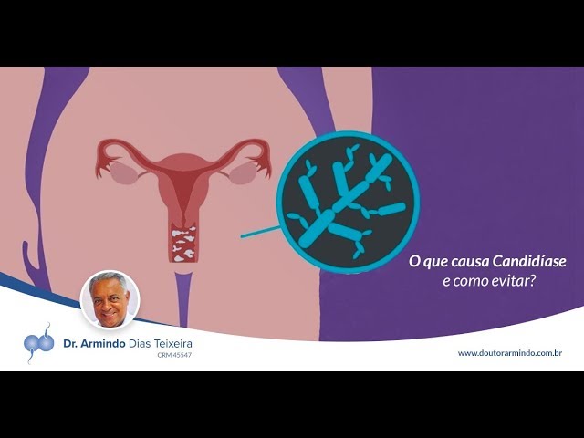 O que é receptividade endometrial e qual sua relação com a fertilidade?, Dr. Augusto Bussab