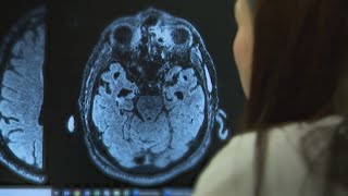 A vote for hope: Prop 14 could change the future of dementia research in Texas
