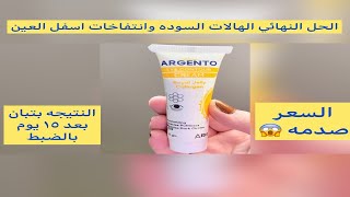 ريفيو عن كريم ارجنتو للعيون كريم للتخلص من الهالات السوده والتخلص من الانتفاخات تحت العيون argento