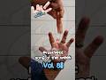 Prosthetic Song of the Week Vol. 86 #prostheticsongoftheweek