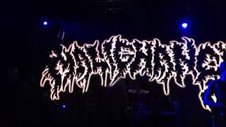 Watch Malignancy Intrauterine Cannibalism live video
