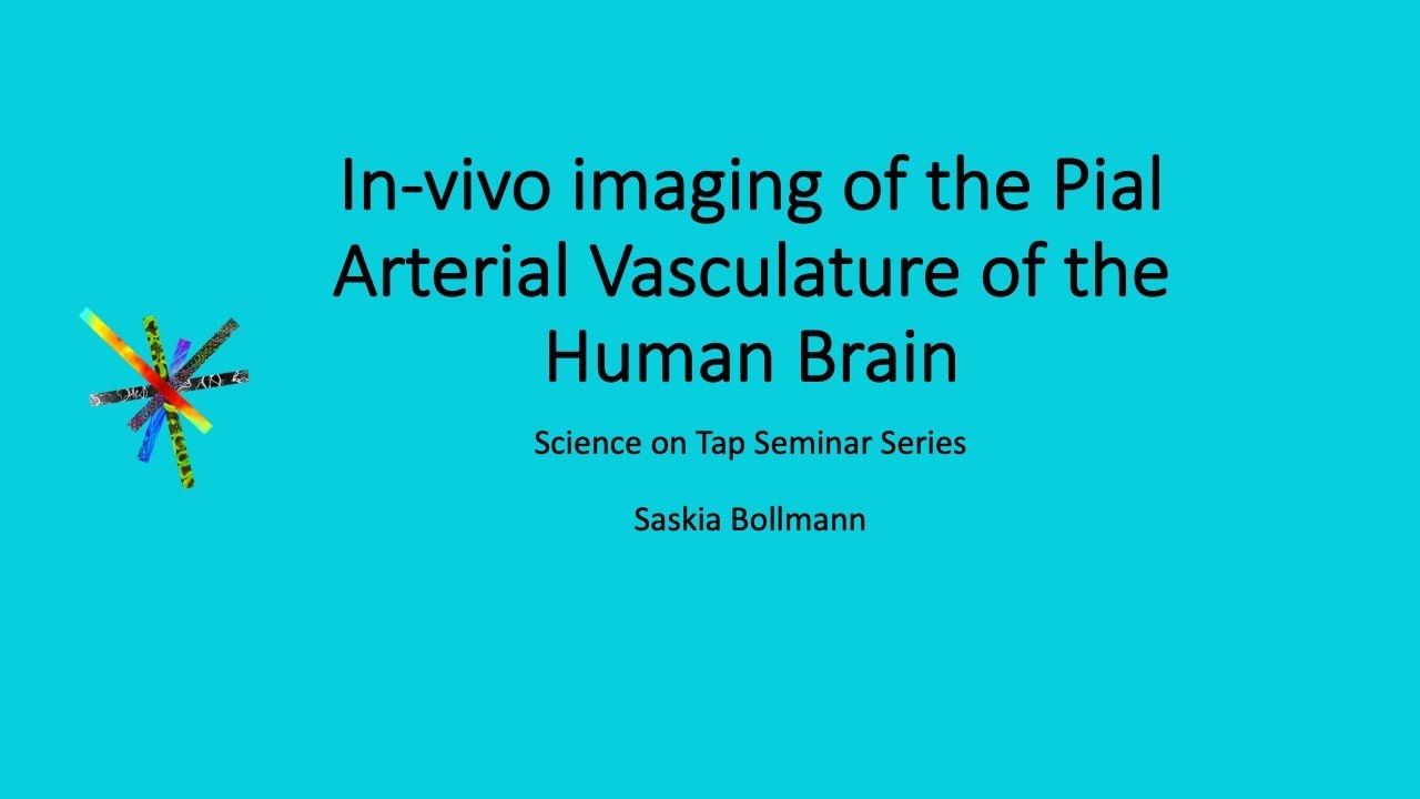 In-vivo Imaging of the Pial Arterial Vasculature of the Human Brain