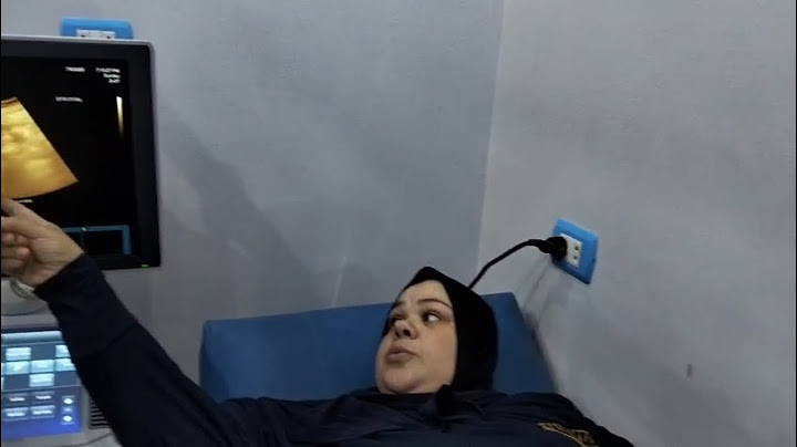ام جني روحت للدكتور 👆