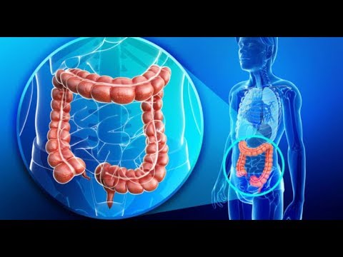 Curățarea și detoxifierea intestinelor - Doza de Sănătate - Curatarea intestinelor la om