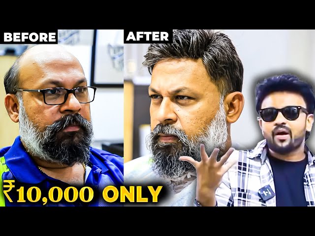 Hair Loss தலையா இப்படி Style தலையா மாத்த முடியுமா? Go Back to your Golden Days in ₹10,000 class=