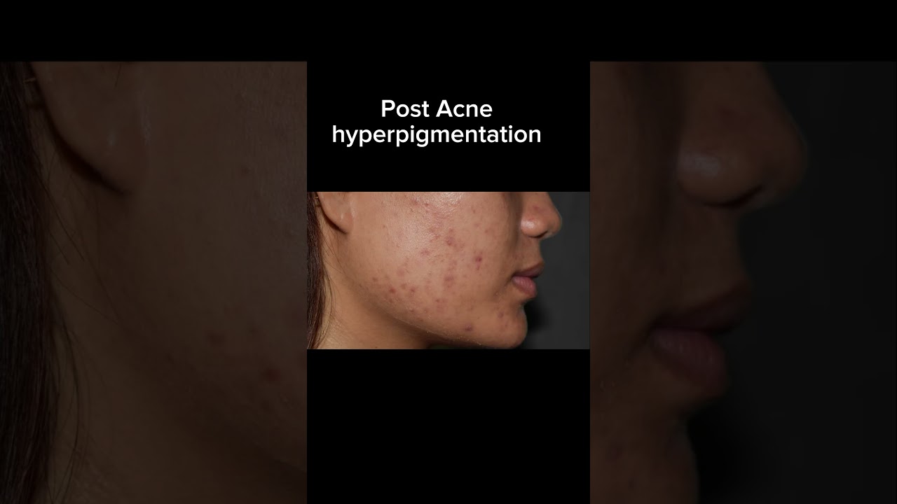 BEST Moisturiser for YOU. 