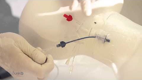 GlySure™ | Continuous Glucose Monitoring System - Training Film