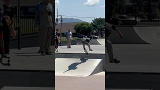 1 Year Since Leg Surgery