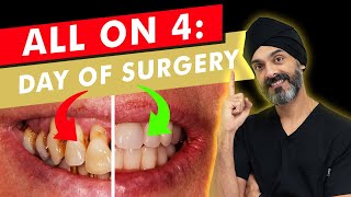 Your Complete Guide to All on 4 Surgery: What to Expect