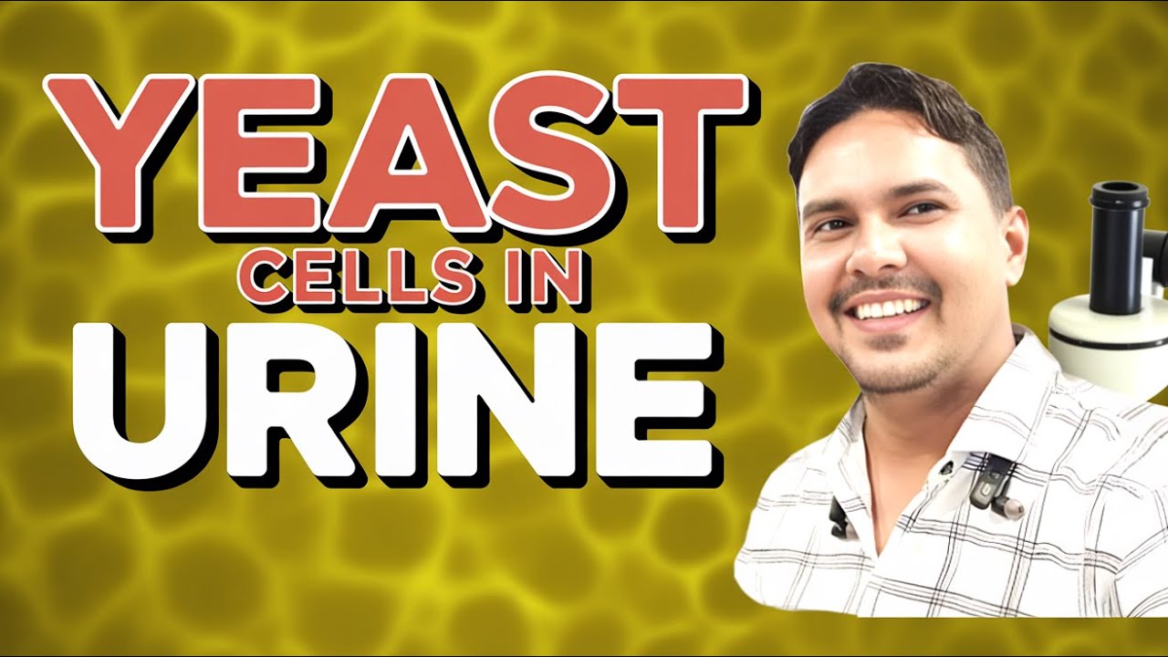 What is Yeast Cells I Budding Yeast cells in urine