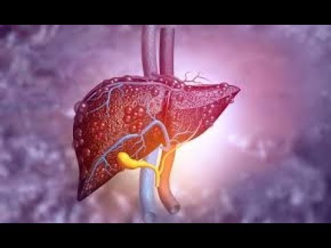 Video: Hoće li me masna jetra ubiti?