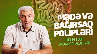 Mədə Və Bağırsaq Poliplərinin Təbii Müalicəsi - Fizuli Hüseynov