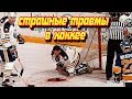 Самые страшные травмы в истории хоккея | Ужасные травмы в НХЛ