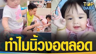 ดราม่าพ่อแม่ไม่สังเกต ชาวเน็ตสงสัยนิ้วกลางข้างขวา“น้องยูจิน”ทำไมงอตลอด จน“ยิว”ชี้แจงด่วน |TOP DARA