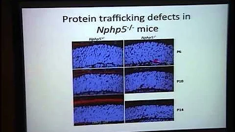 A New Animal Model for Senio-Loken Syndrome
