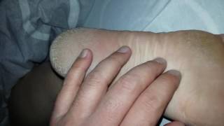 Wife Rough Soles Dry Feet