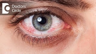 Simple answer to the question is yes, accidental spillage of any
solution eye can cause injury. however most contact lens solutions are
based o...