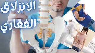 الانزلاق الفقاري/التزحلق الفقاري القطني/انزلاق الفقرات/الم اسفل الظهر/تزحزح الفقرات القطنية