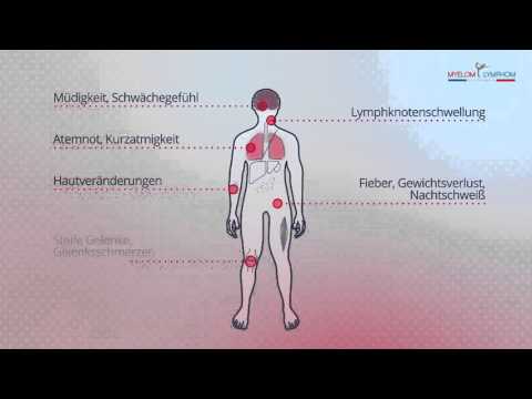 Video: Symptome Eines Lymphoms: Fieber, Hautausschlag Und Mehr
