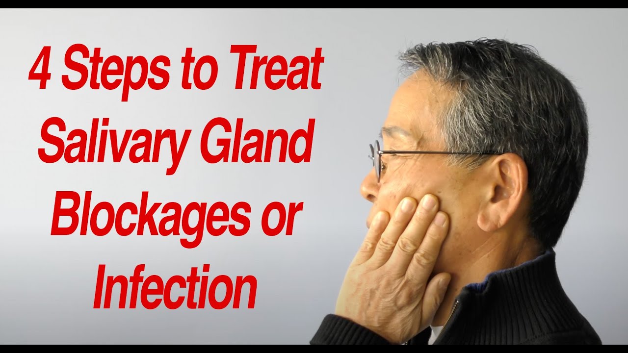 Can A Salivary Gland Burst?