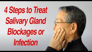 4 Steps To Treat Salivary Gland Swelling At Home