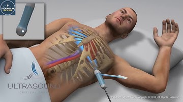 Các Mặt Cắt Siêu Âm Tim Cơ Bản - Hình 3D Rất Dễ Hiểu