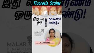 Fluorosis Stains  Causes | Treatment options | Dr Indumathi  | Malar Dental Clinic