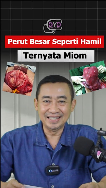 Perut Besar Seperti Hamil, Ternyata Miom | Shorts Dr Yan Daily