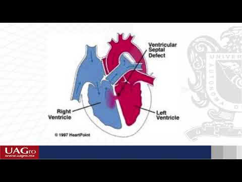 Video: Defecto del tabique ventricular (VSD) en perros