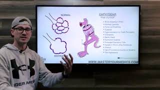 COPD Patients | Feb.  3rd, 2023 Case Study Breakdown