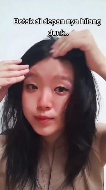Serum Vitamin Obat Penumbuh Rambut Melembutkan Rambut Menumbuhkan Rambut Hasil Permanent Bahan Alami