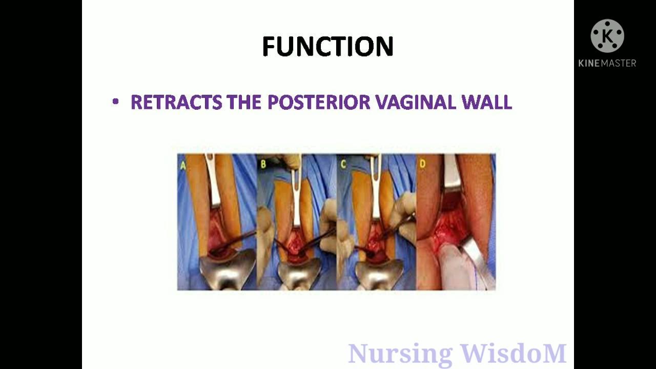 Sims speculum YouTube