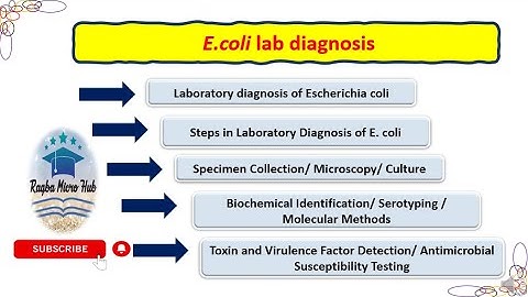 E coli lab diagnosis | Escherichia coli | Laboratory | Steps | Diagmosis #trending #bacteriology