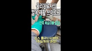 안쪽복숭아뼈(내측복사뼈) 골절! 물리치료사의 골절후 발목 재활과정 - 깁스풀고 1주차