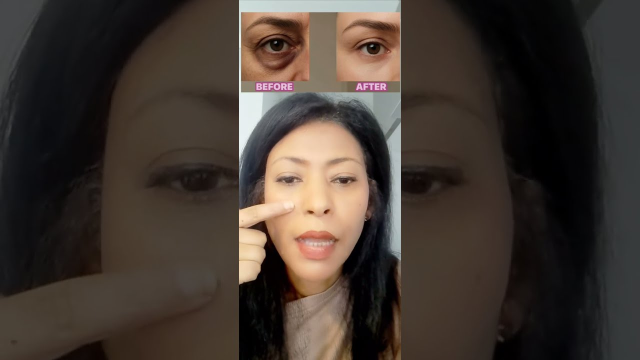  فقط داومي عليها وصفة+ تمرين وشوفي النتيجة بنفسك من الشهر الاول