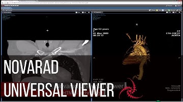 What makes a universal viewer work?