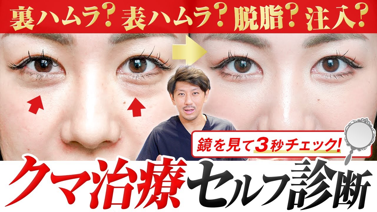 【クマ治療の正しい選び方】脱脂？裏ハムラ？フローチャートと実際の写真であなたの最適な方法がわかります