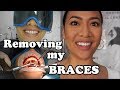 REMOVING MY BRACES | TEETH JOURNEY PART 2 | JACKSSANCHEZTV