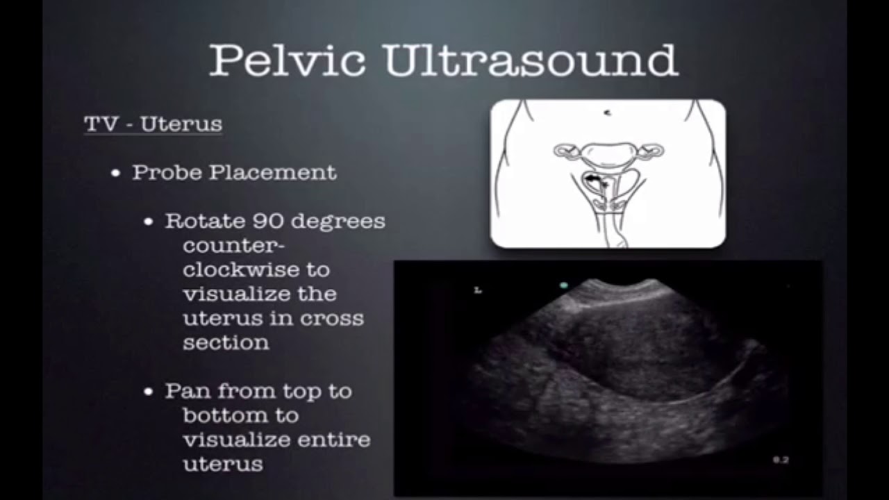 1st Trimester OB US 2018 CUSE