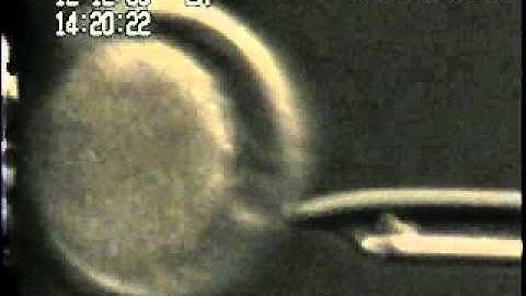 NT Cell Transfer.avi