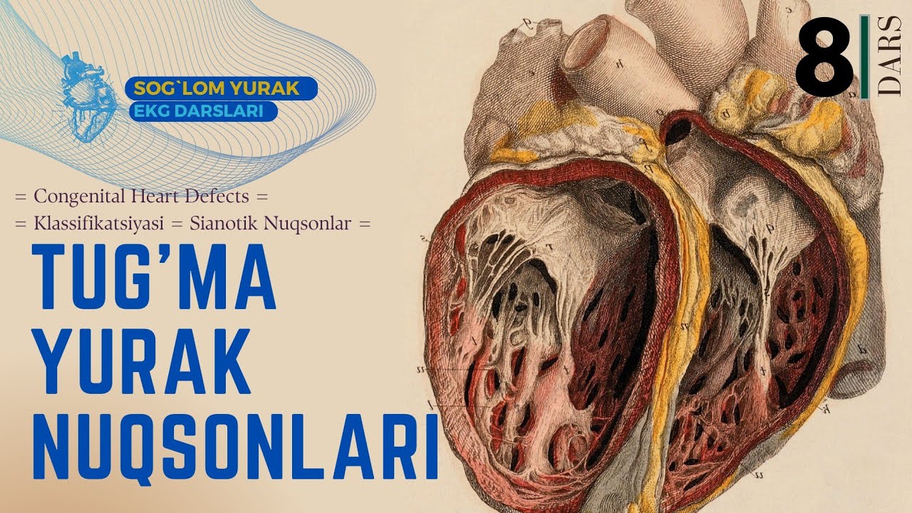 = Tug'ma Yurak Nuqsonlari = Klassifikatsiyasi = Sianotik Nuqsonlar = Congenital Heart Defects =