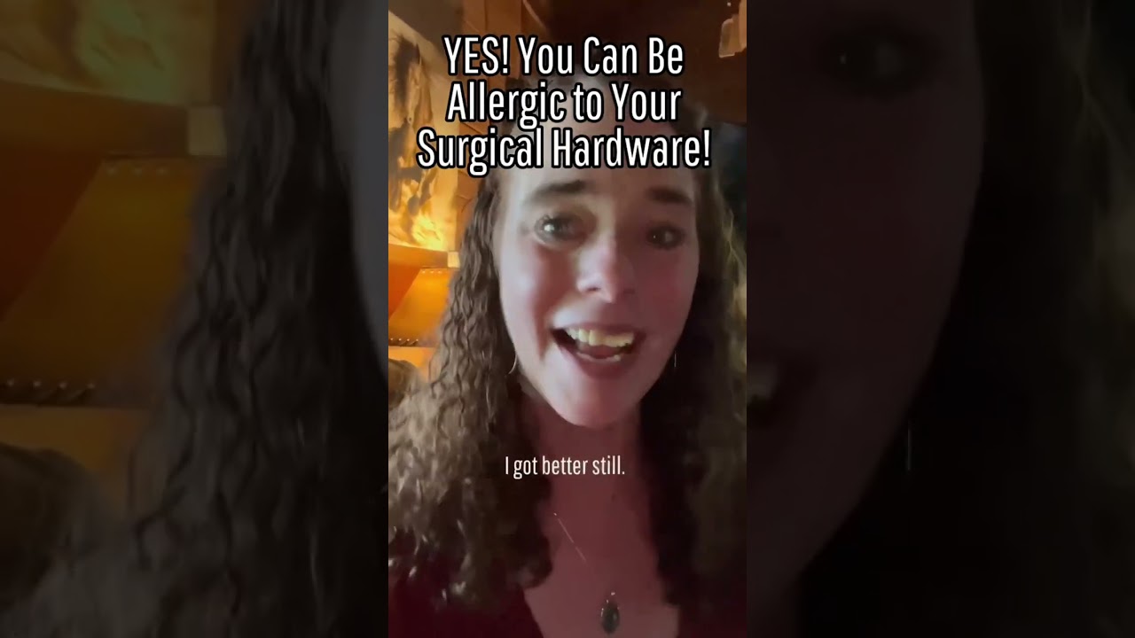 Allergy to Surgical Hardware? Yes, It’s a Thing! #nickelallergy #metalallergies #chronicpain