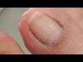 Pedicure GOOD #satisfying Neldz SOLO Parent  is live!