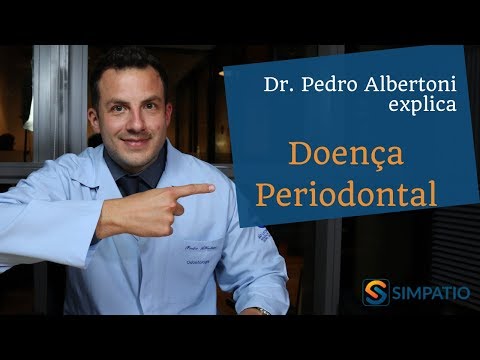 Vídeo: Periodontite Dentária - Causas E Sintomas De Periodontite Aguda E Crônica, Diagnóstico, Tratamento E Prevenção