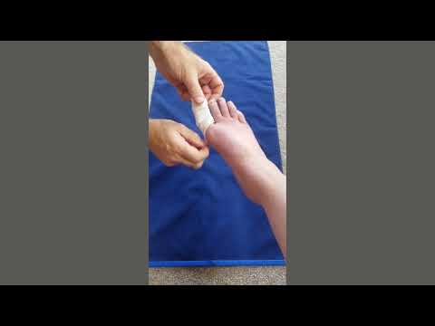 Video: 3 Ways to Give First Aid to a Cut Finger
