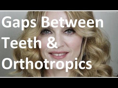 Causes of Gaps Between Upper & Lower Front Teeth Diastema by Prof John Mew
