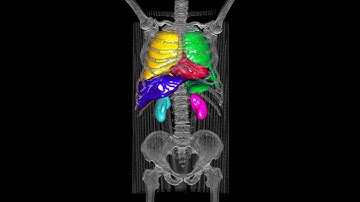 Automatic Organ Segmentation from CT