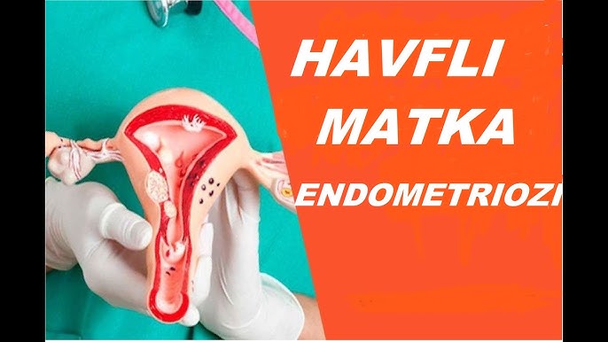 Porno qiz dost Qora ayollar porno videolar