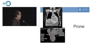 SGRT for Left Sided Breast Cancer: the evidence